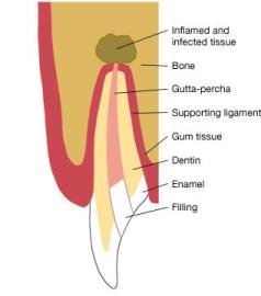 endosurgery endosurgery